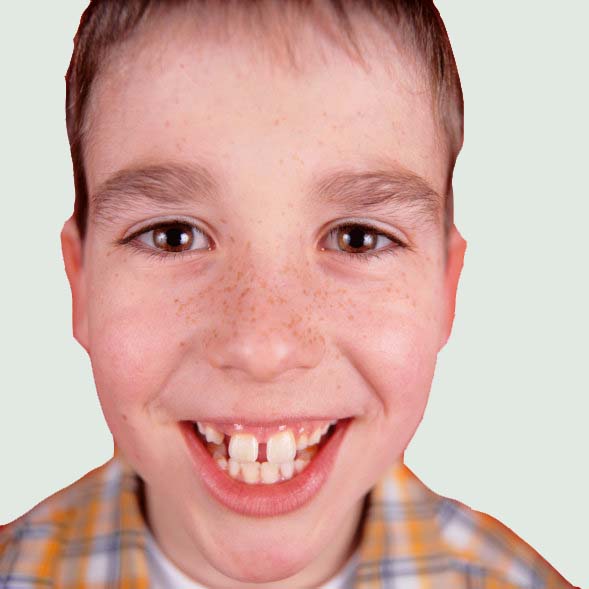 Dentalhygiene
